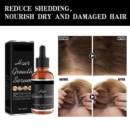 Strong And Thick Hairline Moisturizing Hair